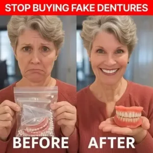 🔥🔥🔥Ends Today: 70% OFF!🦷Pryxo™ Custom-Fit Full Functional Dentures Make you more confident