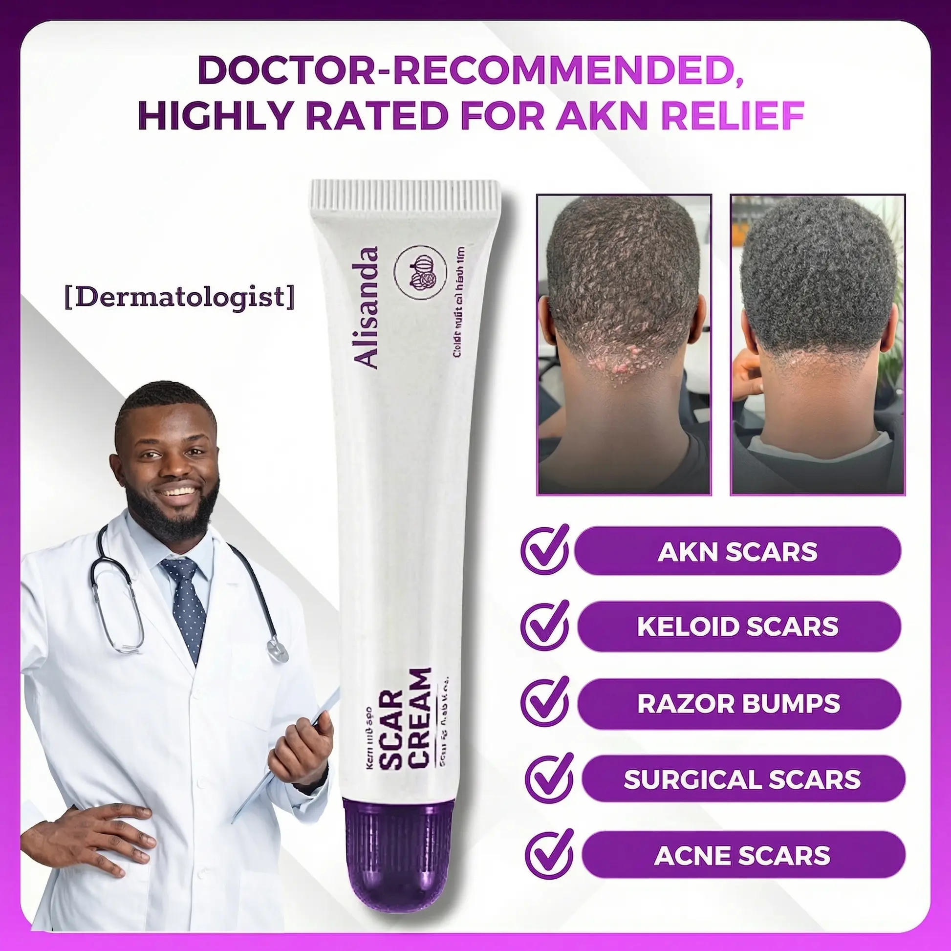 Keloid & Raised Scar Removal Cream | Alisanda 2026