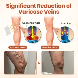 VitaCuroK™ Vein Patch 2026 | Fast Varicose Vein Relief