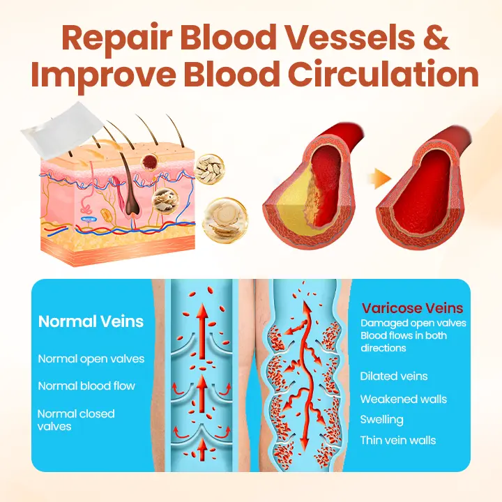 VitaCuroK™ Vein Patch 2026 | Fast Varicose Vein Relief