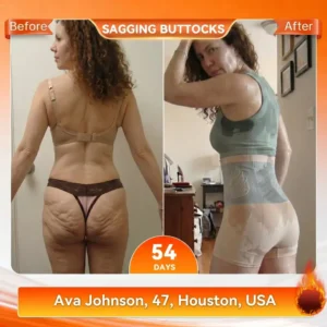 Voerza® 2026 NEW RELEASE Moringa & Berberine 4‑In‑1 Micro‑Particle Sculpting & Fat‑Burn Shorts
