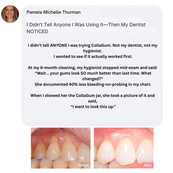 CollaGum™ Smile Strengthening Collagen Powder