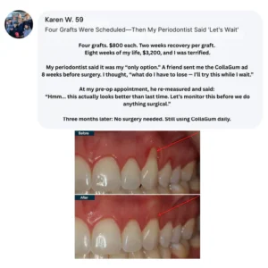 CollaGum™ Smile Strengthening Collagen Powder
