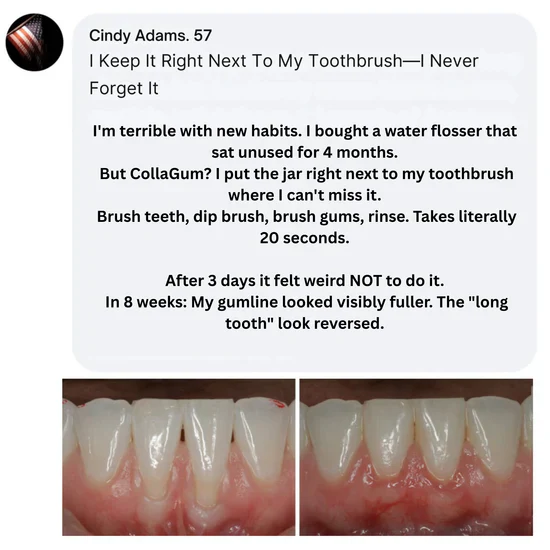 CollaGum™ Smile Strengthening Collagen Powder