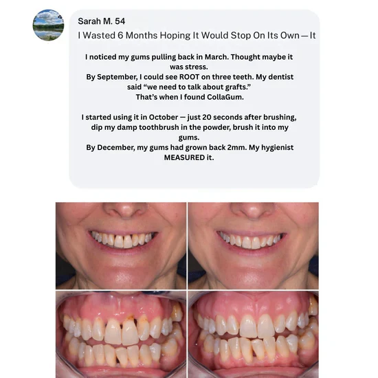 CollaGum™ Smile Strengthening Collagen Powder