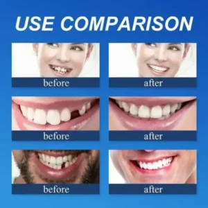Jakhuors® Premium Denture 2026 | Custom Fit Denture