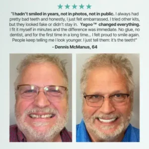 Yagoo™ Custom Custom-Fit Full Functional Dentures