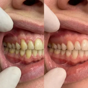 CollaGum™ Smile Strengthening Collagen Powder
