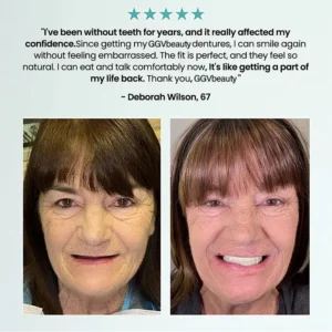 🦷 Fit Full Functional DenturesMake you more confident