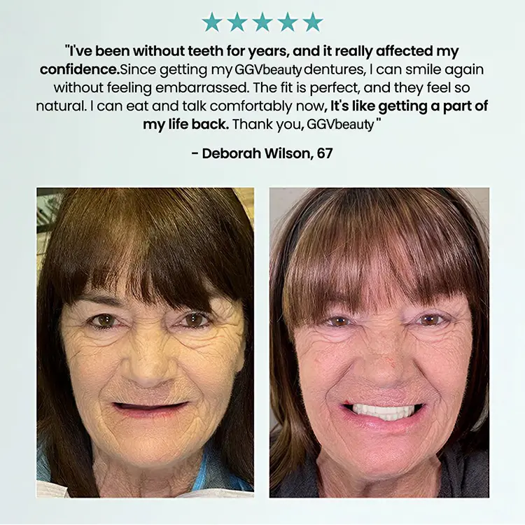 🦷 Fit Full Functional DenturesMake you more confident
