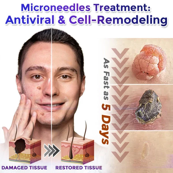 Bellevery Microneedle Patch Roll