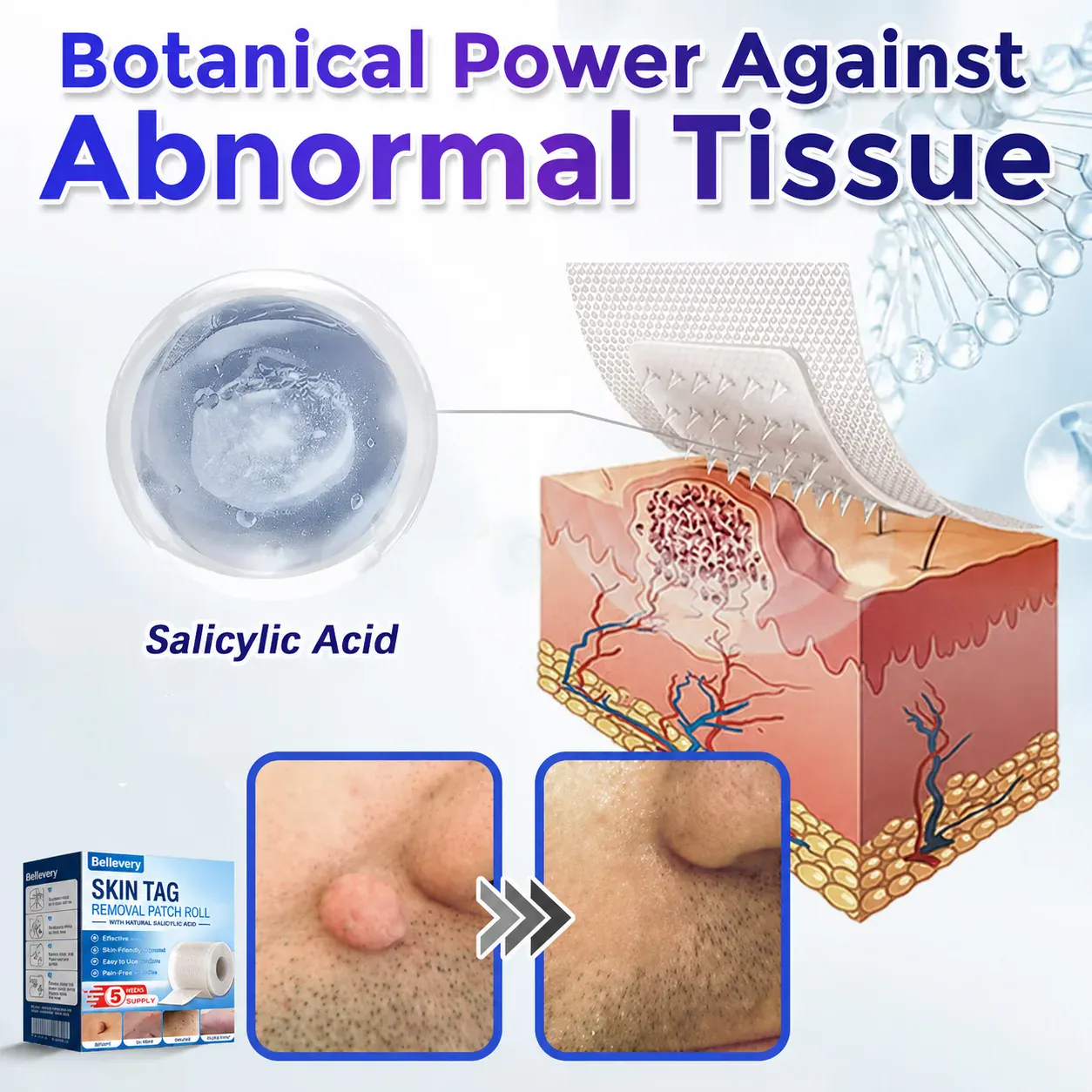Bellevery Microneedle Patch Roll