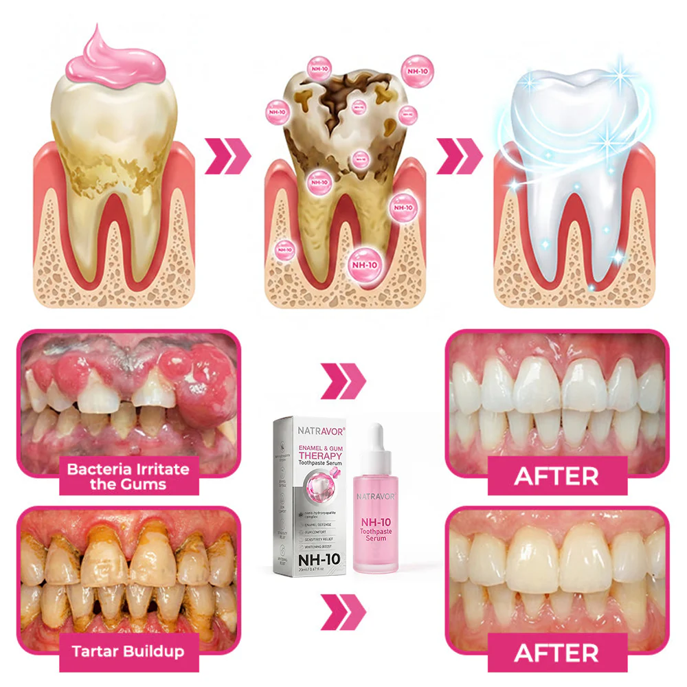 Natravor Thismile NH-10 Toothpaste Serum | Enamel & Gum Care