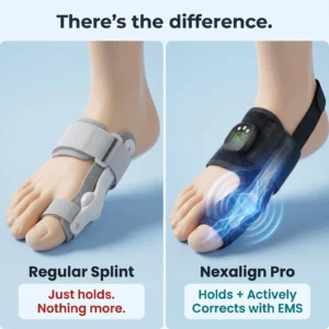 Aurora Tech EMS Bunion Corrector