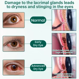 BalanceVie OptiClear Nano Eye Roller Serum
