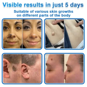 Bellevery® 2-in-1 Microneedle + Hydrocolloid Skin Patch Repair System