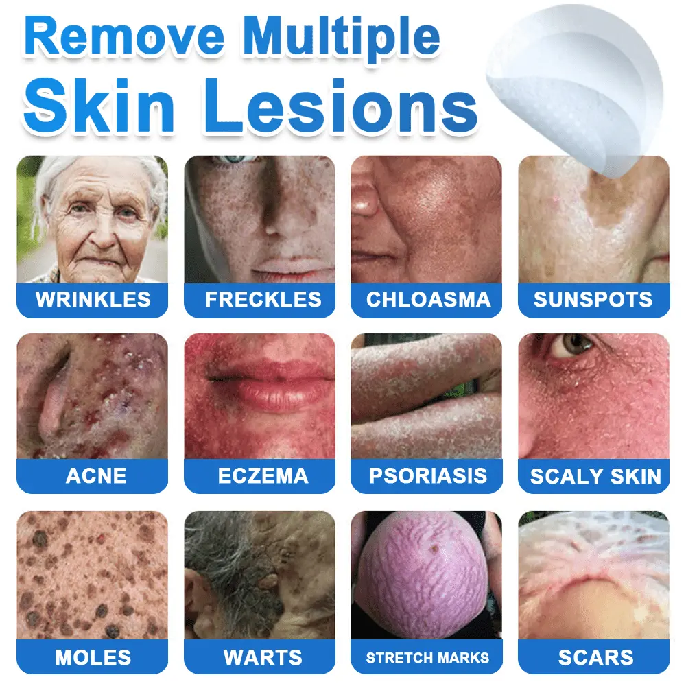 Bellevery® 2-in-1 Microneedle + Hydrocolloid Skin Patch Repair System