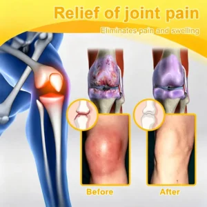 Bellevery Joint & Bone Recovery Patch | Targeted Joint Comfort