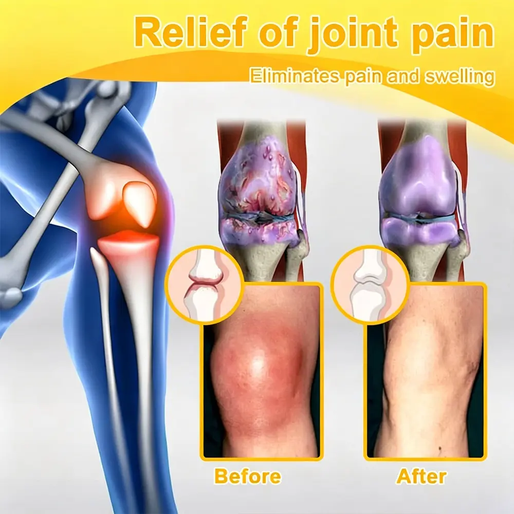 Bellevery Joint Comfort Support Patch