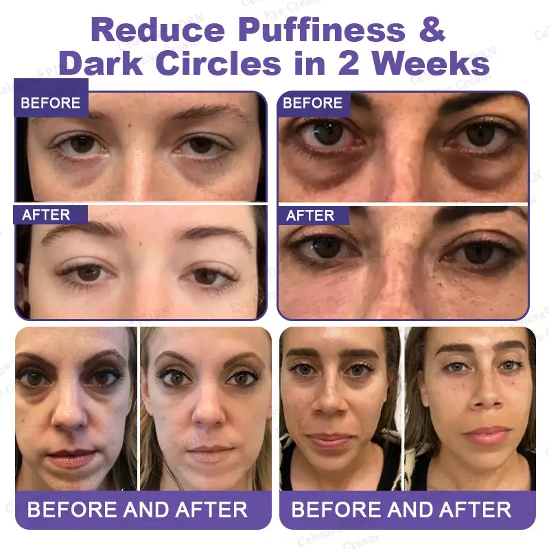 Bellevery® PDRN Renewal Complex Eye Cream