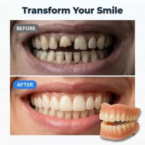 Custom Fit Denture Set | Adhesive-Free Suction Fit Dentures