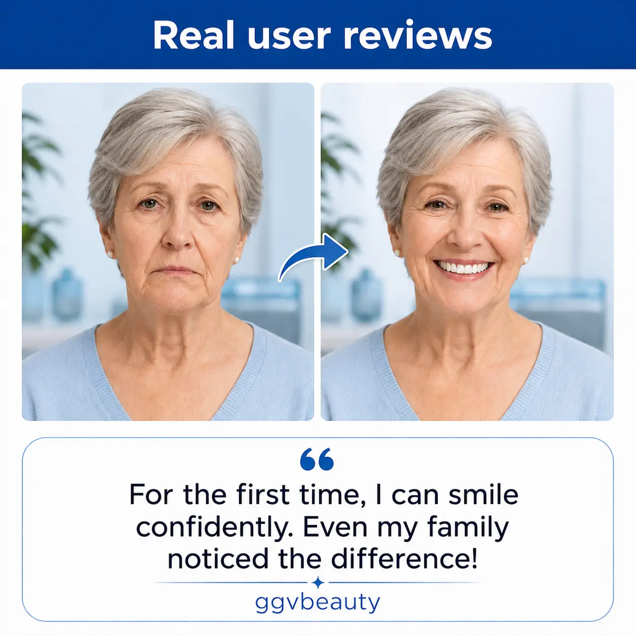 Custom-Fit Dentures - At-Home Moldable Denture Set for Men & Women