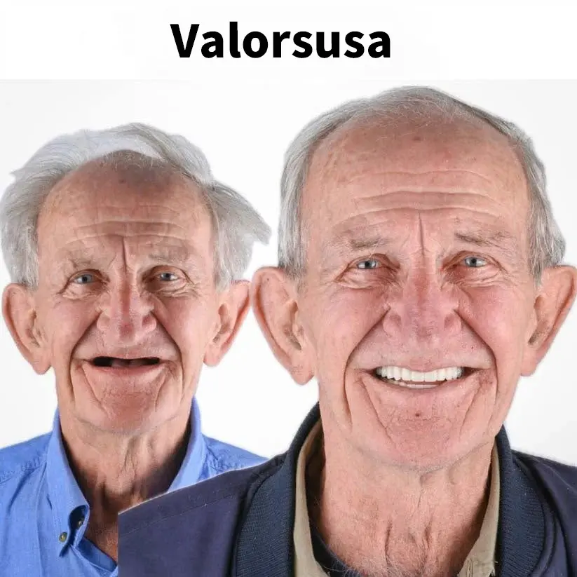 Custom-Fit Instant Smile Dentures – Natural Looking Comfort Fit