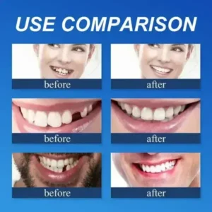 –Ends Today: 75% OFF! ⏰DarkFairy™ Medical Full Denture with Strong Suctiond Custom-Fit Full Functional Dentures🦷