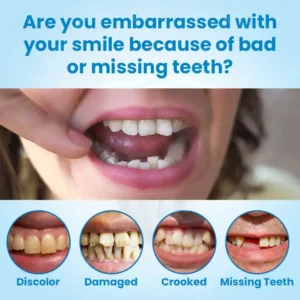 Full Cover Dentures