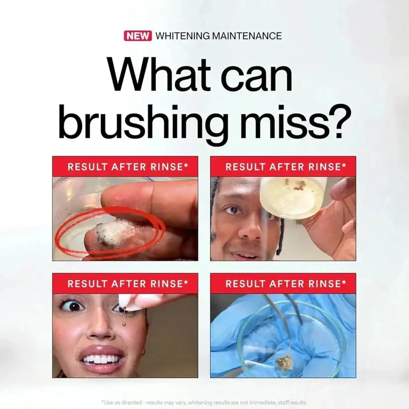 🦷ID Stain Whitening Mouthwash - Maiakoo®