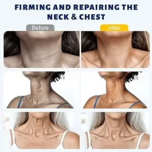 Instant Neck Firming Cream with 5-Ball Roller & Retinol