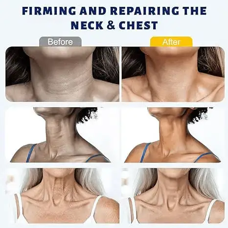 Instant Neck Firming Cream with 5-Ball Roller & Retinol