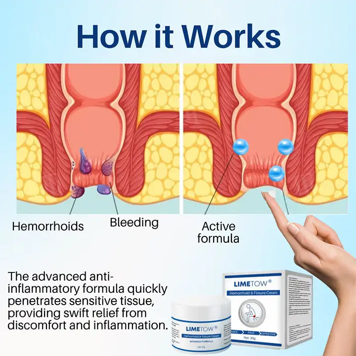 LIMETOW® 𝗛𝗲𝗺𝗼𝗿𝗿𝗵𝗼𝗶𝗱 & 𝗙𝗶𝘀𝘀𝘂𝗿𝗲 𝗖𝗿𝗲𝗮𝗺