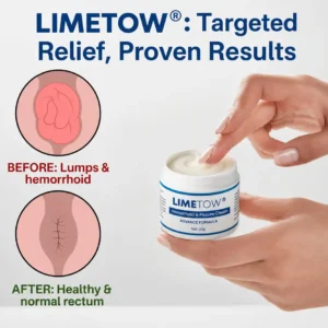 LIMETOW® 𝗛𝗲𝗺𝗼𝗿𝗿𝗵𝗼𝗶𝗱 & 𝗙𝗶𝘀𝘀𝘂𝗿𝗲 𝗖𝗿𝗲𝗮𝗺