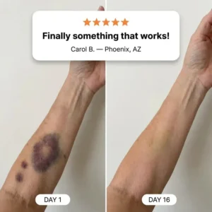 MAIAKOO® Bruise Repair & Skin-Strengthening Cream