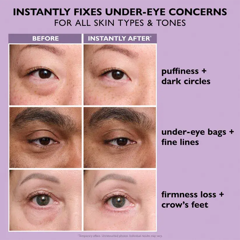 Maiakoo Instant Lift Eye Gel for Puffiness, Bags & Wrinkles