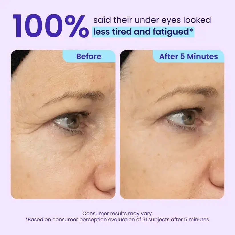 Maiakoo Instant Lift Eye Gel for Puffiness, Bags & Wrinkles