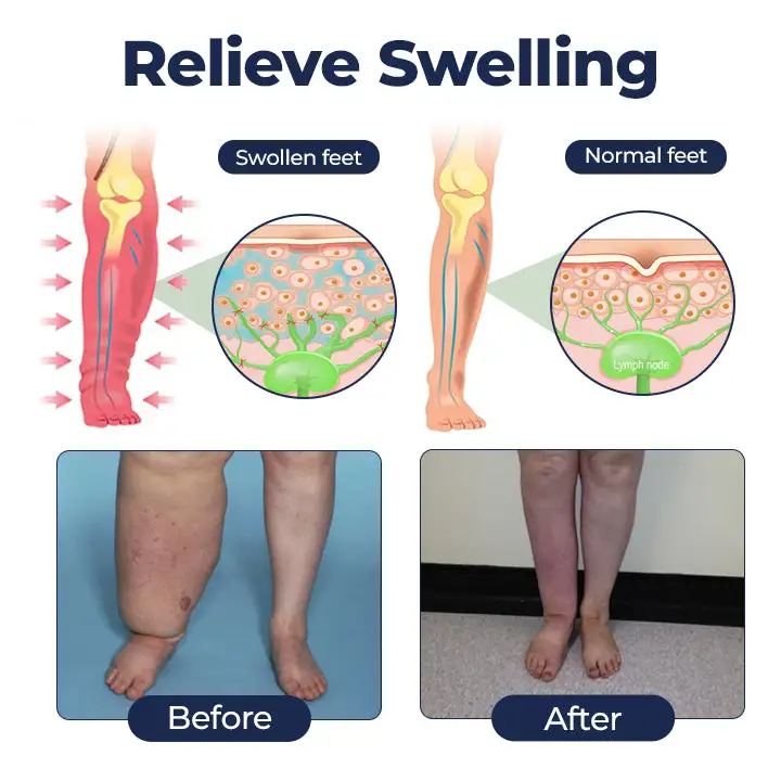 NEYEROS® SwellRelief Circulation Support Cream