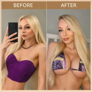 💥NEYEROS® 💥Targeted Breast Enhancement Advanced Nano Microneedle Patch💥💥💥