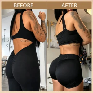💥NEYEROS® 💥Targeted Breast Enhancement Advanced Nano Microneedle Patch💥💥💥