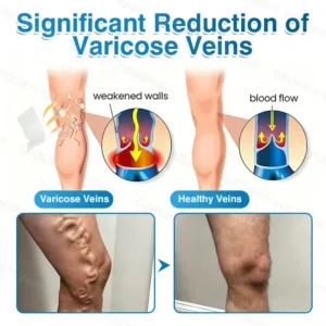 NEYEROS® VeinRepair Microneedle Patch Roll | Spider Vein Care