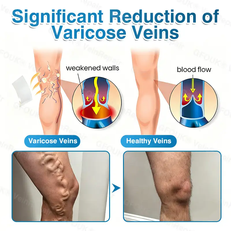 NEYEROS® VeinRepair Microneedle Patch Roll | Spider Vein Care