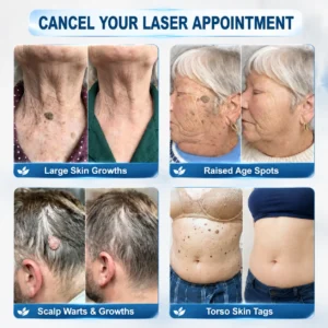 Natravor® 7-Day Skin Tag & Spot Eraser Painless & Scar-Free Advanced Skin Renewal Roller Pen