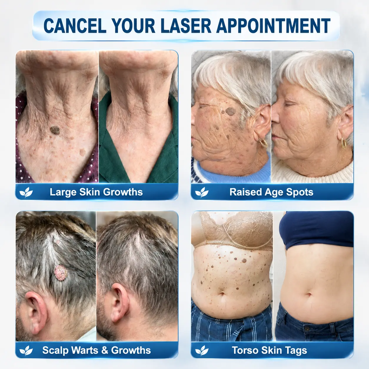 Natravor® 7-Day Skin Tag & Spot Eraser Painless & Scar-Free Advanced Skin Renewal Roller Pen