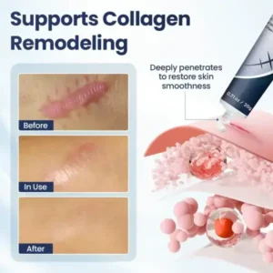 Nexisify® DERMALUX Texture Repair Gel