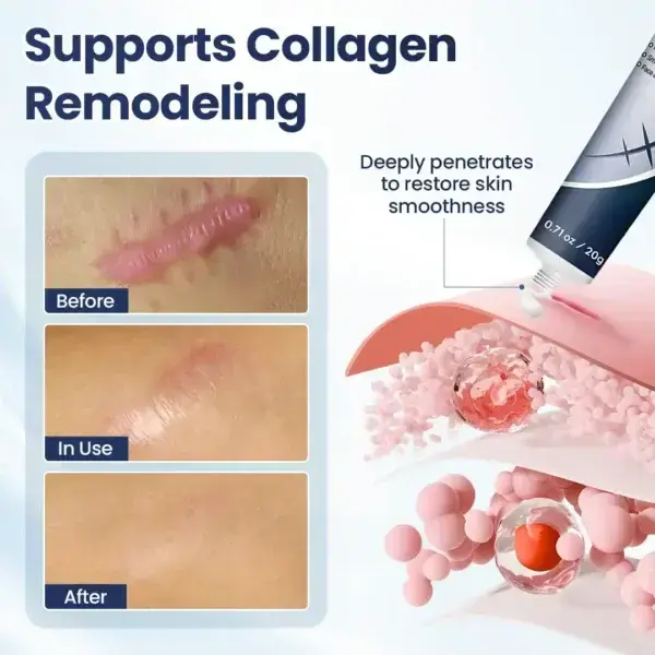 Nexisify® DERMALUX Texture Repair Gel
