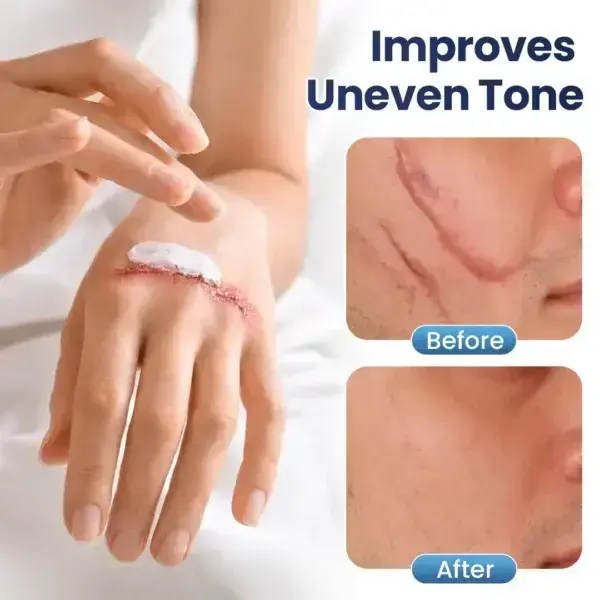 Nexisify® DERMALUX Texture Repair Gel