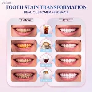 Neyeros® Niacinamide Toothpaste