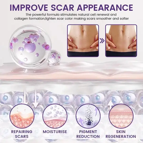 TopSpire® ReGenScar Stem Cell Scar Gel