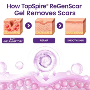 TopSpire® ReGenScar Stem Cell Scar Gel